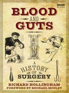 Кровь и внутренности. История хирургии